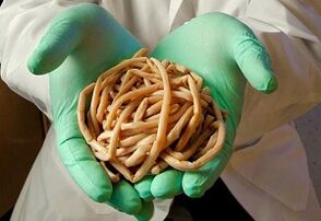 Wéi Worms falen an de mënschleche Kierper