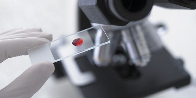 Blutt Test fir Parasiten am Kierper ze diagnostizéieren