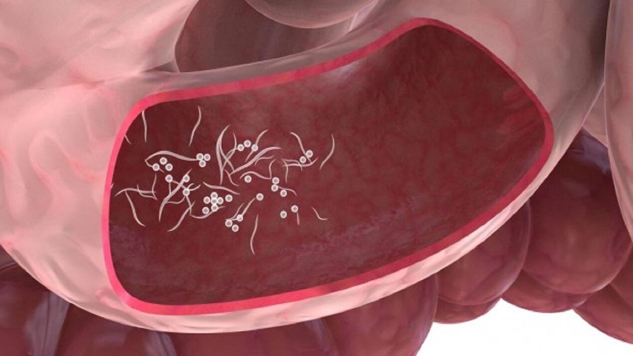 Giardia Parasiten an der Liewer