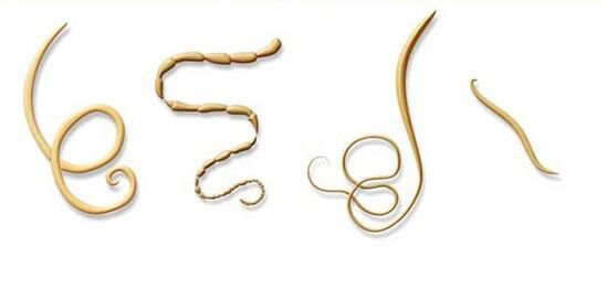 déi meescht üblech Aarte vu Parasiten