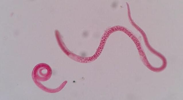 wéi gesäit trichinella aus