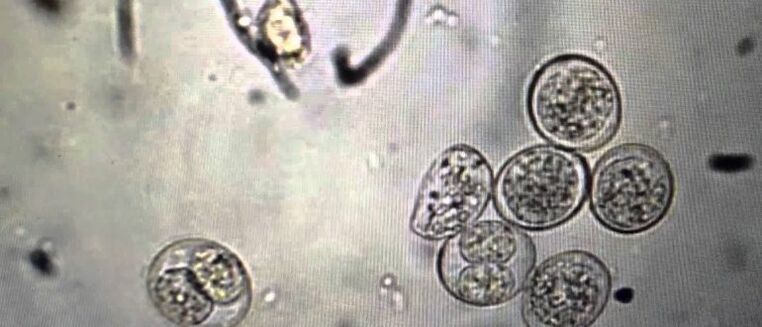 protozoan Parasitzellen